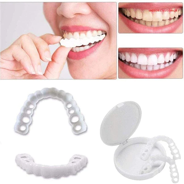 Lente Dental White® - Kit Superior + Inferior (TOTALMENTE AJUSTÁVEL A TODAS ARCADAS DENTÁRIAS)